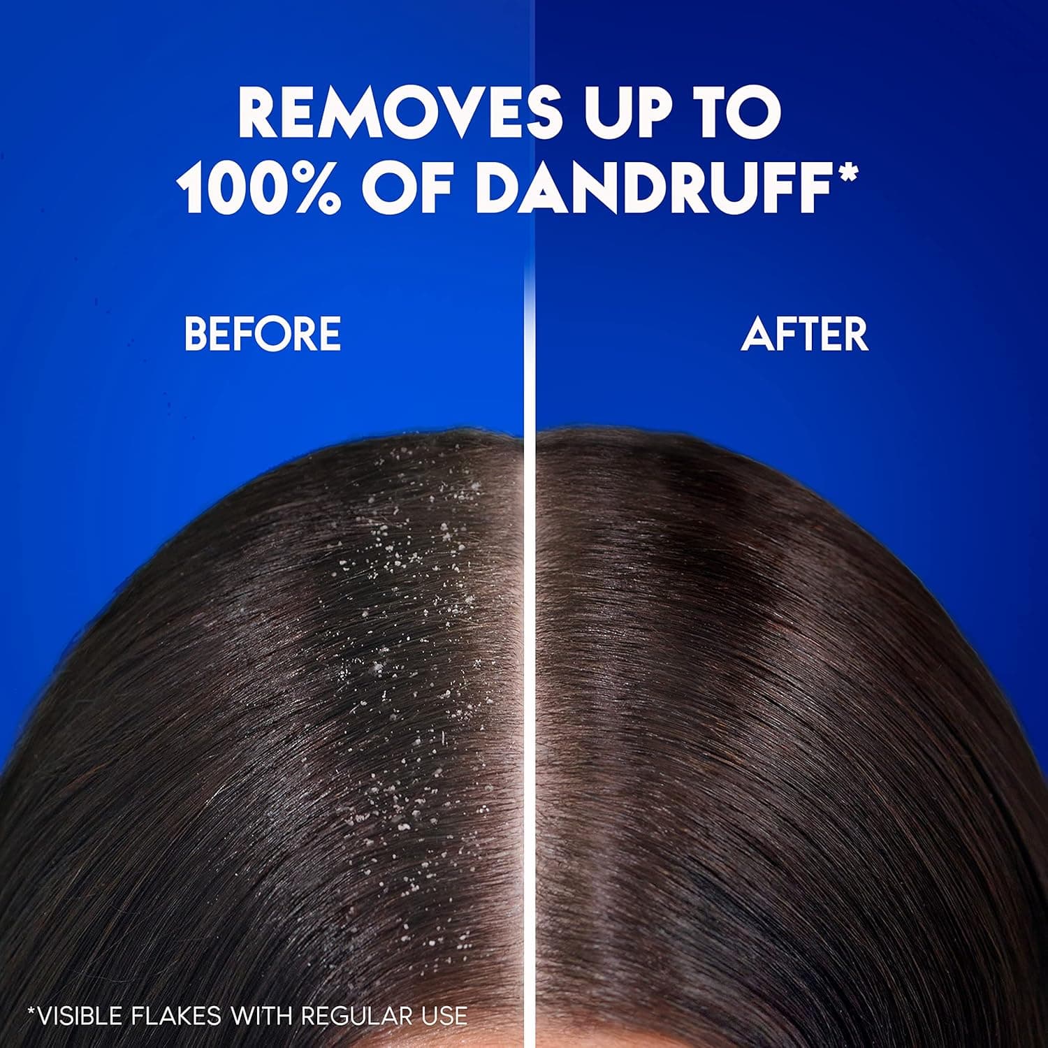 Head & Shoulders Charcoal Detox Anti-Dandruff Shampoo 400 ml